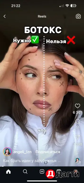 массаж , Холодная плазма