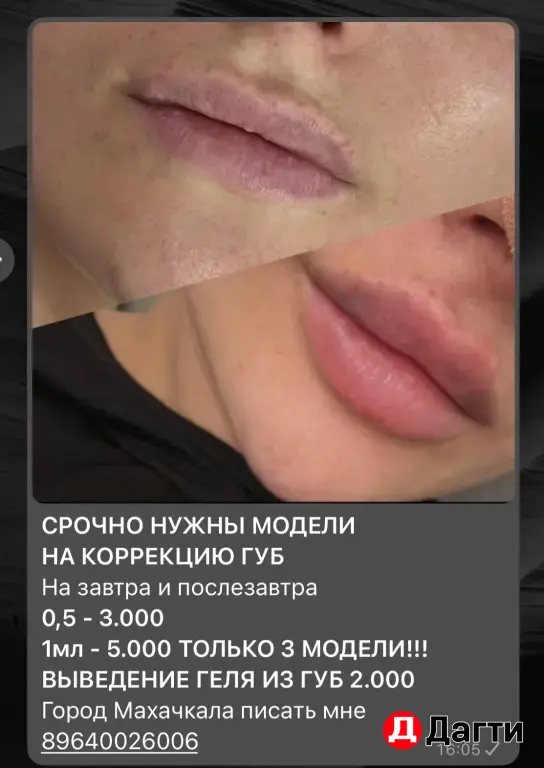 чистка лица